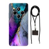 Senada Xiaomi Xiaomi Redmi 14C ile Uyumlu Kılıf Desenli Altın Tozu Silikon İpli Boyun Askı Aparatlı