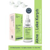 S'he Vec Hi Girls Bye Pores 30 ml Gözenek Sıkılaştırıcı ve Leke Karşıtı Yüz Serumu