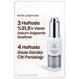 Skinvibes Leke ve Karşıtı Azelaik Asit Kompleks Serum Arbutin ve Niasinamid 30 ml