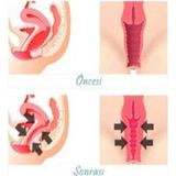 Solmazlar Online Vagitight Kadınlar Için Genital Bölge Şekillendirici Krem 100 ml x 2 Adet - Belirtilmemiş