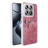 Spia Xiaomi 14T ile Uyumlu Kılıf Açık Pembe Nopt Silikon Kapak (Xiaomi 14T ile Uyumlu, Açık Pembe)