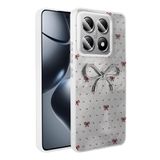 Spia Xiaomi 14T Pro ile Uyumlu Kılıf Açık Mavi Nopt Silikon Kapak (Xiaomi 14T Pro ile Uyumlu, Açık Mavi)