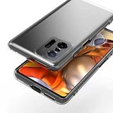 Spia Xiaomi Mi 11T Pro 5G ile Uyumlu Kılıf Kamera Korumalı Şeffaf Yui Silikon Kapak (Xiaomi Mi 11T Pro 5G ile Uyumlu, Kamera Korumalı Şeffaf)