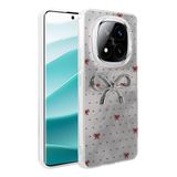 Spia Xiaomi Redmi Note 14 Pro Plus ile Uyumlu Kılıf Açık Mavi Nopt Silikon Kapak (Xiaomi Redmi Note 14 Pro Plus ile Uyumlu, Açık Mavi)