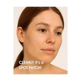 Stopever Clearly Spot Patch, Sivilce Karşıtı Şeffaf Plaster | Şeffaf, Ultra Ince, Hidrokolloid + Niacinamide + Salicylic Asit Içerikli Akne Karşıtı Yüz Bandı | 24 Adet - standart