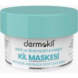 Store Akne ve Siyah Nokta Karşıtı Kil Maskesi 50 ml