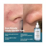 Storemax Clasycare Niacinamide Akne Karşıtı Serum – Gözenek Sıkılaştırıcı, Yağ Dengesi ve Cilt Aydınlatıcı Serum – Siyah Nokta ve Leke Karşıtı Yüz Serumu, 50 ml