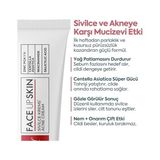 Şura Ticaret Akne Kremi Yüz Için – Sivilce ve Akne Karşıtı Leke Kremi – Salisilik Asit & Niasinamid ile Leke Giderici – Genç ve Yetişkin Cilt Bakımı, 40 ml