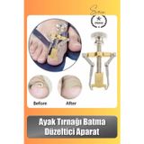 Svein #Tırnak Ayak Tırnağı Batma Düzeltici Aparat Düzeltici Evde Kolay Pratik Batık Tırnak Bakım Aleti