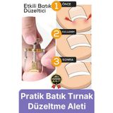 Svein #Tırnak Kolay Bakım Orijinal Çelik Batma Ağrıyı Azaltan Düzeltme Aleti Batık Tırnak Çıkartıcı Aparat