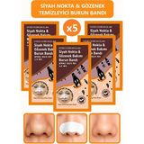 TBY Shop 5'li Siyah Nokta ve Gözenek Temizleyici Burun Bandı