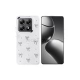Techtrove Xiaomi 14T Pro Kılıf Kabartmalı Desenli Simli Şeffaf A Kalite Kapak Uyumlu Fiyonk