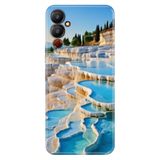 Tecno Pova Neo 4 ile Uyumlu Kılıf, Pamukkale Temalı Desenli, Darbe Emici Silikon