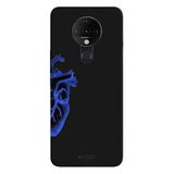 Tecno Pova Neo İle Uyumlu Siyah Blue Heart Desenli Silikon Kılıf