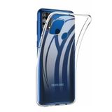 Teleplus Samsung Galaxy M31 Lüks Tpu Silikon Nano Ekran Koruyucu Cep Telefonu Kılıfı
