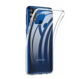 Teleplus Samsung Galaxy M31 Lüks Tpu Silikon Şeffaf Cep Telefonu Kılıfı