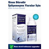 T&H Gelişmiş Yara Izi Jeli. Yara Kremi, Anti-yara Izi, Yara Izi Giderici, Medikal Silikon Ve Kolajen