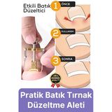 #Tırnak Kolay Bakım Orijinal Çelik Batma Ağrıyı Azaltan Düzeltme Aleti Batık Tırnak Çıkartıcı Aparat
