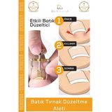 #Tırnakdüzeltici Profesyonel Ayak Bakım Aparatı Ev Tipi Etkili Tırnak Çıkartıcı Batık Tırnak Düzeltici