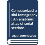 Title: Computerized axial tomography An anatomic atlas of [Hardcover]