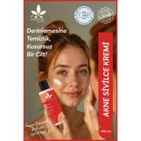 Tuana Kozmetik Akne Ve Çil Leke Karşıtı Cilt Kremi 100 ML