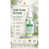 Tuliplifeoffical Anti Acne Serum 30 ml – Salisilik Asit %2 İçeren Gözenek Sıkılaştırıcı, Akne Görünümü ve Leke Karşıtı Cilt Serumu
