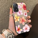 Ucuc Xiaomi Redmi Note 11 Pro 4g/5g Uyumlu Sert Akrilik Arka Silikon Kenar Lens Koruma Şık Baskı Kılıf - Siyah