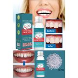 Uni zer 30 Ml Diş Onarım Kiti Eksik Diş Dolgu Yapma Katı Tutkal Seti Protez Boncuk Diş