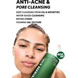 Universal Sivilce & Akne & Siyah Nokta Karşıtı Yüz Temizleme Jeli, Niacinamide Çay Ağacı Yağı, 400 ml