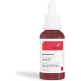 Uravas Store Wıwıfy Gözenek Sıkılaştırıcı Akne Karşıtı Yenileyici Botanikal Kolajen Peeling Serum (AHA10% + Bha2%) 30 ml Red Peelıng Serum