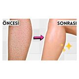 UVEA/GLYCO-8-RENEW-COMPLEX-8-GLIKOLIK-ASIT-KOLTUK-ALTI-DIZ-DIRSEK-VE-BACAK-ARASI-KARARMA-GORUNUMU-OLU-DERI-KALINTILARI-ICIN-YENILEYICI-PEELING-BAKIMI-250-ML