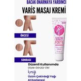 Var.is Bölgesi Için Bacak Onarmaya Yardımcı Besleyici Varyforte Masaj Kremi 100ml