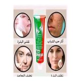 VESCO Vesca Forte krem Melazma Kremi Çil Kremi Kremi Akne Ve Cilt Kusurları Onarıcı