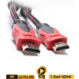 Vetech HDMI Kablo 1.5 Metre Örgü Sargılı Dayanıklı Full Hd Televizyon / Monitör / Tv HDMI Kablosu