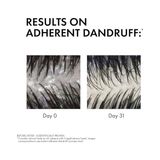Vıchy Dercos Anti Dandruff Kuru Saçlar Için Kepek Karşıtı Şampuan 200 ml - Option-1
