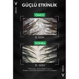 Vichy Dercos Anti-Peliculare Anti-Dandruff Kepek Karşıtı Şampuan 390 Ml - Kuru Saçlar İçin Yoğun Kepek Karşıtı Ve Yatıştırıcı Saç Bakım Şampuanı