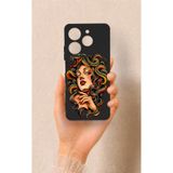 Vip Case Tecno Spark 10 Pro Uyumlu Medusa Desenli Silikon Kılıf, Siyah