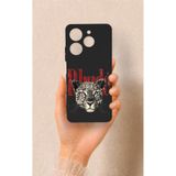 Vip Case Tecno Spark 10 Pro Uyumlu Rhude Desenli Silikon Kılıf, Siyah
