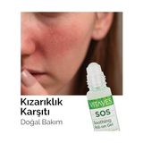 Vıtayes Sos Cilt Serumu - Akne ve Sivilce Önleyici, Siyah Nokta, Cilt Kızarıklığı, Kaşıntı, Sinek Böcek Isırması Karşıtı Onarıcı Çay Ağacı Yağı ve Provitamin B5 Serumu, Üçlü Ambalaj 30 ml - standart