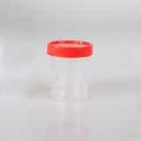 Vonderlab Idrar Numune Kabı Non-Steril 50 x 100 ML