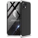 Wowacs Xiaomi Mi 11 Lite ile Uyumlu Kılıf 3 Parçalı Tam Koruma Dayanıklı Soft Ince Kılıf - Siyah - Gri