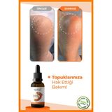 Wyess Ayak Ve Topuk Çatlağı Bakım Yağı 30 ml