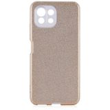 Xiaomi Mi 11 Lite Kılıf Renkli Parıltılı Simli Işıltılı Silikon Kapak Shining