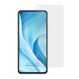Xiaomi Mi 11 Lite Temperli Nano Cam Ekran Koruyucu