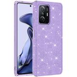 Xiaomi Mi 11t Pro 5g Kılıf Renkli Parıltılı Simli Işıltılı Silikon Kapak Shining