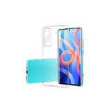 Xiaomi Mi 12 Uyumlu Kılıf Şeffaf Süper Silikon Kapak