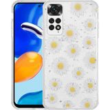 Xiaomi Redmi Note 11 Global Kılıf Simli Desenli Kamera Korumalı Parlak Klfs Popy Kapak-Papatya