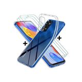 Xiaomi Redmi Note 11 Pro - 12 Pro 4G Uyumlu Kılıf Kamera Korumalı Şeffaf Silikon +Ekran Koruyucu Cam