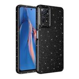 Xiaomi Redmi Note 12 Pro 4G Kılıf Kamera Korumalı Simli Lüks Zore Koton Kapak