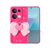 Xiaomi Redmi Note 13 Pro 4g Kılıf Kamera Korumalı Figür Tasarımlı Kapya Kapak